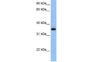 WB Suggested Anti-CHN2 Antibody Titration: 0.