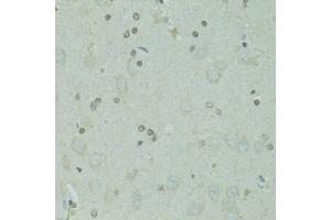Immunohistochemistry of paraffin-embedded rat brain using GTF2H2C antibody  at dilution of 1:100 (40x lens). (GTF2H2C 抗体  (AA 1-300))