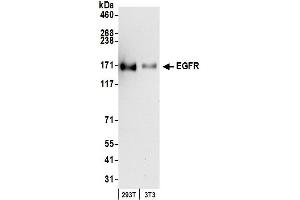 Western Blotting (WB) image for anti-Epidermal Growth Factor Receptor (EGFR) (C-Term) antibody (ABIN7454624)