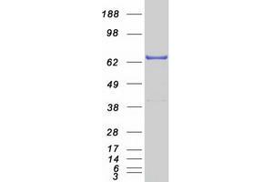 Western Blotting (WB) image for Tyrosyl-DNA Phosphodiesterase 1 (TDP1) (Transcript Variant 1) protein (Myc-DYKDDDDK Tag) (ABIN2733393)