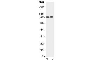 Western blot testing of EPB41L1 antibody and Lane 1:  rat brain;  2: mouse brain lysate. (EPB41L1 抗体  (C-Term))