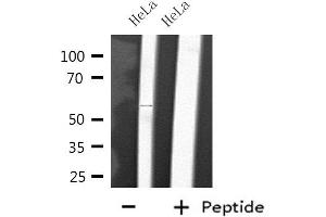 Western blot analysis of extracts from HeLa cells, using CYP2D6 antibody. (CYP2D6 抗体)