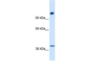 WB Suggested Anti-NCOR1 Antibody Titration:  0.
