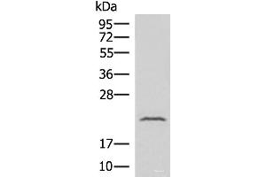 Western blot analysis of Human fetal liver tissue lysate using IFNA8 Polyclonal Antibody at dilution of 1:500 (IFNA8 抗体)