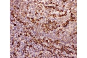 Immunohistochemistry (IHC) image for anti-Integrin beta 2 (ITGB2) (AA 17-382) antibody (ABIN3031376)