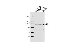 Western blot analysis of lysates from C2C12, MCF-7, Hela cell line (from left to right), using HSP90B1 Antibody (Center) (ABIN655868 and ABIN2845274).