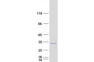 RND3 Protein (Myc-DYKDDDDK Tag)