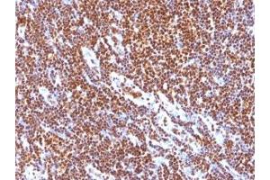 Formalin-fixed, paraffin-embedded human tonsil stained with SUMO-1 antibody (SUMO1/1188) (SUMO1 抗体)