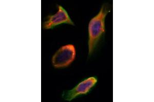 ABIN6258323 and ABIN6275586 staining Hela by IF/ICC.