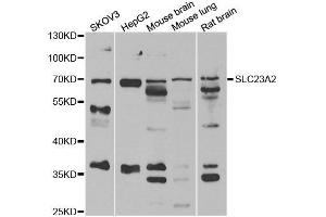 Western blot analysis of extracts of various cell lines, using SLC23A2 antibody. (SLC23A2 抗体)
