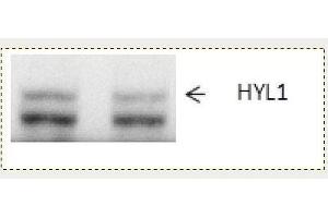 Western Blotting (WB) image for anti-Epoxide Hydrolase 1, Microsomal (Xenobiotic) (EPHX1) antibody (ABIN334544) (EPHX1 抗体)
