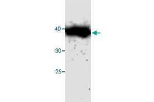 Western blot analysis in CTSH recombinant protein with CTSH monoclonal antibody, clone 69s45  at 1 : 1000 dilution. (Cathepsin H 抗体)