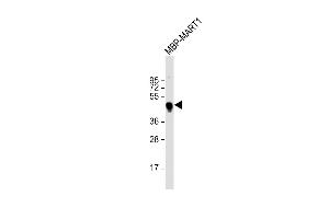 Anti-MBP tag Antibody at 1:2000 dilution + Recombinant MBP RT1 lysate Lysates/proteins at 20 μg per lane. (MBP Tag 抗体)