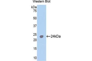 Detection of Recombinant TNNI1, Human using Polyclonal Antibody to Troponin I Type 1, Slow Skeletal (TNNI1) (TNNI1 抗体  (AA 142-187))