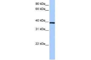 WB Suggested Anti-ZNF618 Antibody Titration:  0. (ZNF618 抗体  (N-Term))