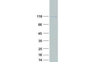Western Blotting (WB) image for Glucosidase, Alpha, Neutral AB (GANAB) (Transcript Variant 2) protein (Myc-DYKDDDDK Tag) (ABIN2714632)