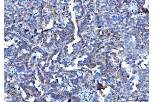 IHC analysis of Poliovirus Receptor/PVR using anti-Poliovirus Receptor/PVR antibody (ABIN7601072). (Poliovirus Receptor 抗体  (AA 28-331))