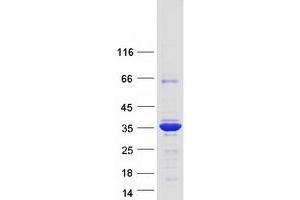 Validation with Western Blot