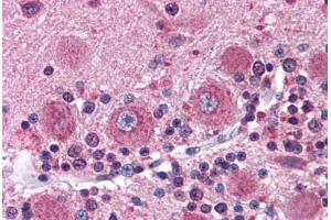 Human Brain, Cerebellum (formalin-fixed, paraffin-embedded) stained with DISC1 antibody ABIN337351 at 10 ug/ml followed by biotinylated goat anti-rabbit IgG secondary antibody ABIN481713, alkaline phosphatase-streptavidin and chromogen. (DISC1 抗体  (C-Term))
