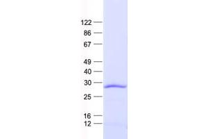 Western Blotting (WB) image for Spi-C Transcription Factor (Spi-1/PU.1 Related) (SPIC) protein (His tag) (ABIN2732583)