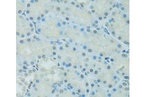 Immunohistochemistry of paraffin-embedded Rat kidney using CEBPA Polyclonal Antibody at dilution of 1:100 (40x lens). (CEBPA 抗体)