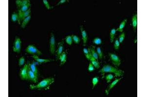 Immunofluorescent analysis of Hela cells using ABIN7152694 at dilution of 1:100 and Alexa Fluor 488-congugated AffiniPure Goat Anti-Rabbit IgG(H+L) (FARP2 抗体  (AA 261-550))