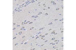 Immunohistochemistry of paraffin-embedded rat brain using TMC1 antibody (ABIN5996250) at dilution of 1/100 (40x lens). (TMC1 抗体)