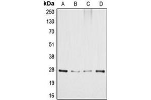 Western blot analysis of GADD153 expression in HeLa (A), MCF7 (B), SP2/0 (C), PC12 (D) whole cell lysates. (DDIT3 抗体  (Center))