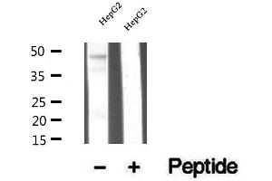 Western blot analysis of extracts of HepG2 cells, using TRBP antibody. (TARBP2 抗体  (Internal Region))