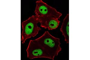 Fluorescent image of MCF-7 cells stained with GATA3 Antibody (Center) (ABIN1944795 and ABIN2838499). (GATA3 抗体  (AA 1-444))