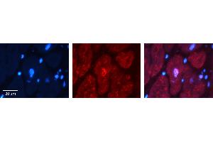 Rabbit Anti-BUB3 Antibody Catalog Number: ARP58599_P050 Formalin Fixed Paraffin Embedded Tissue: Human heart Tissue Observed Staining: Nucleus Primary Antibody Concentration: 1:100 Other Working Concentrations: N/A Secondary Antibody: Donkey anti-Rabbit-Cy3 Secondary Antibody Concentration: 1:200 Magnification: 20X Exposure Time: 0. (BUB3 抗体  (N-Term))