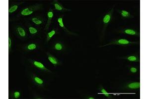 Immunofluorescence of purified MaxPab antibody to ZNF124 on HeLa cell. (ZNF124 抗体  (AA 1-289))