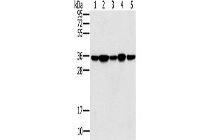 Western Blotting (WB) image for anti-Protein Phosphatase 1, Catalytic Subunit, gamma Isoform (PPP1CC) antibody (ABIN5550180) (PPP1CC 抗体)