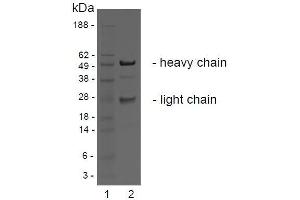 SDS-PAGE analysis of purified BBX-1H1 monoclonal antibody. (LGR4 抗体)