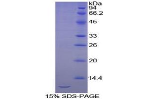 SDS-PAGE (SDS) image for Cadherin 1, Type 1, E-Cadherin (Epithelial) (CDH1) protein (ABIN3008552)
