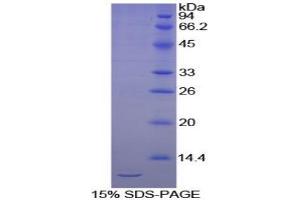 SDS-PAGE analysis of Chicken Cadherin, Epithelial Protein. (E-cadherin 蛋白)