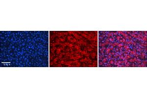 Rabbit Anti-SLC26A3 Antibody  Catalog Number: ARP31608_P050 Formalin Fixed Paraffin Embedded Tissue: Human Adult liver  Observed Staining: Cytoplasmic,Nuclear Primary Antibody Concentration: 1:600 Secondary Antibody: Donkey anti-Rabbit-Cy2/3 Secondary Antibody Concentration: 1:200 Magnification: 20X Exposure Time: 0. (SLC26A3 抗体  (Middle Region))