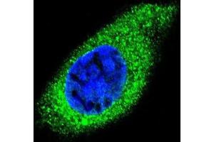 Immunofluorescence (IF) image for anti-Collagen, Type XXI, alpha 1 (COL21A1) antibody (ABIN2996551) (COL21A1 抗体)