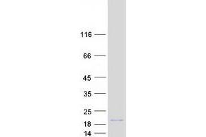 Validation with Western Blot