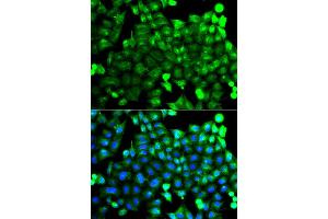 Immunofluorescence analysis of A549 cell using NCALD antibody. (NCALD 抗体)