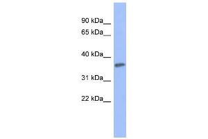 WB Suggested Anti-PRKCG Antibody Titration: 0. (PKC gamma 抗体  (Middle Region))