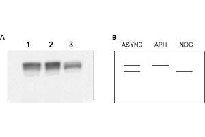 Image no. 1 for anti-Minichromosome Maintenance Complex Component 2 (MCM2) (AA 21-31) antibody (ABIN401335) (MCM2 抗体  (AA 21-31))