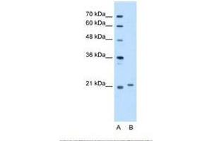 Image no. 1 for anti-Titin-Cap (Telethonin) (TCAP) (C-Term) antibody (ABIN321410) (TCAP 抗体  (C-Term))