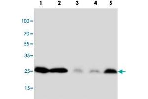 Western blot analysis of tissue and cell extracts with PTN polyclonal antibody . (Pleiotrophin 抗体  (C-Term))