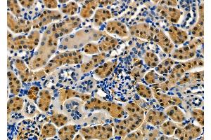 ABIN6257917 and ABIN6274882 at 1/100 staining Mouse kidney tissue by IHC-P.