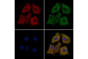 ABIN6260006 and ABIN6279136 staining HepG2 cells by IF/ICC. (AQP11 抗体  (Internal Region))