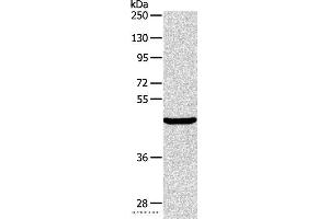 Western blot analysis of Mouse pancreas tissue, using ALKBH1 Polyclonal Antibody at dilution of 1:400 (ALKBH1 抗体)