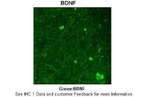 Sample Type :  Rhesus macaque spinal cord  Primary Antibody Dilution :  1:300  Secondary Antibody :  Donkey anti Rabbit 488  Secondary Antibody Dilution :  1:500  Color/Signal Descriptions :  Green: BDNF  Gene Name :  BDNF  Submitted by :  Timur Mavlyutov, Ph. (BDNF 抗体  (Middle Region))