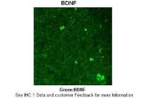 Sample Type :  Rhesus macaque spinal cord  Primary Antibody Dilution :  1:300  Secondary Antibody :  Donkey anti Rabbit 488  Secondary Antibody Dilution :  1:500  Color/Signal Descriptions :  Green: BDNF  Gene Name :  BDNF  Submitted by :  Timur Mavlyutov, Ph. (BDNF 抗体  (Middle Region))