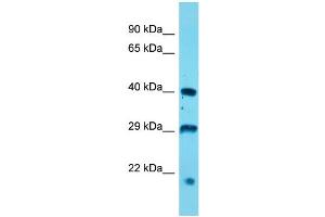 Host: Rabbit  Target Name: Usp12  Sample Tissue: Mouse Stomach lysates  Antibody Dilution: 1. (USP12 抗体  (N-Term))